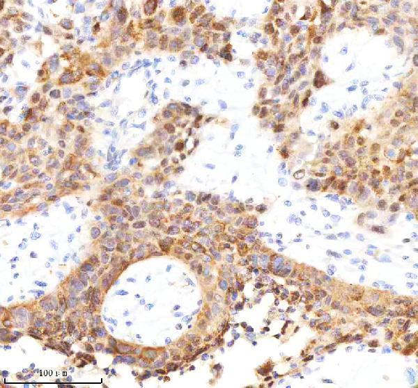 m00300 3 sqstm1 primary antibodies ihc testing 4