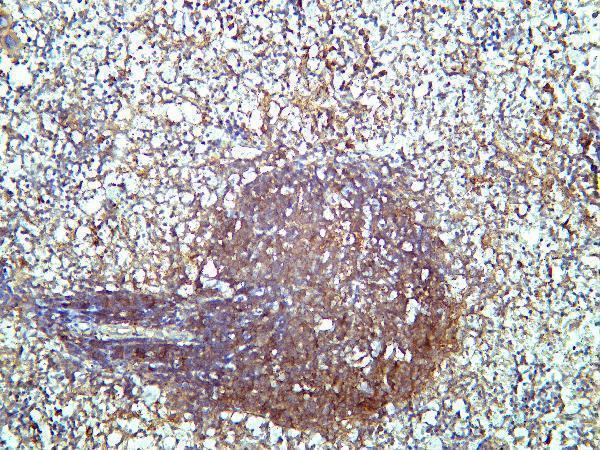 Mouse spleen tissue was stained with Anti-SQSTM1/p62 rabbit Antibody
