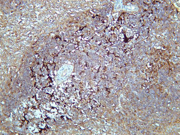 Rat spleen tissue was stained with Anti-SQSTM1/p62 rabbit Antibody