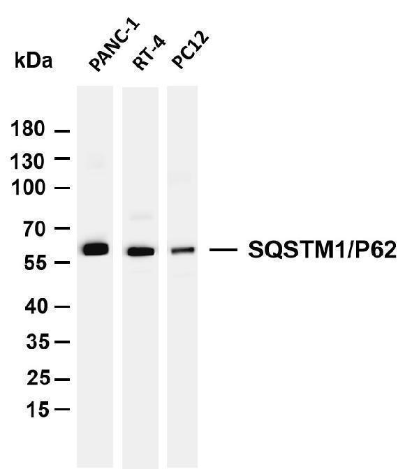 m00300 5 sqstm1 primary antibodies wb testing 1