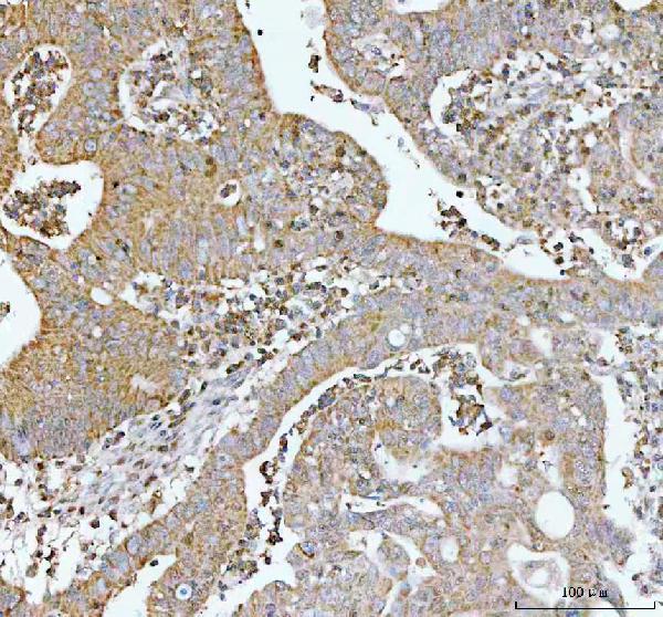  IHC analysis of p62/SQSTM1 using anti-p62/SQSTM1 antibody (M00300)