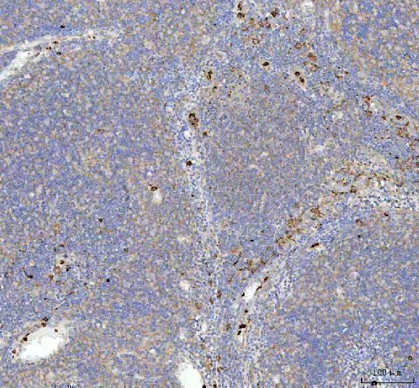  IHC analysis of p62/SQSTM1 using anti-p62/SQSTM1 antibody (M00300)