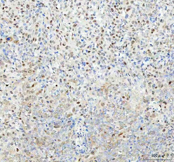 m00300 sqstm1 primary antibodies ihc testing 4