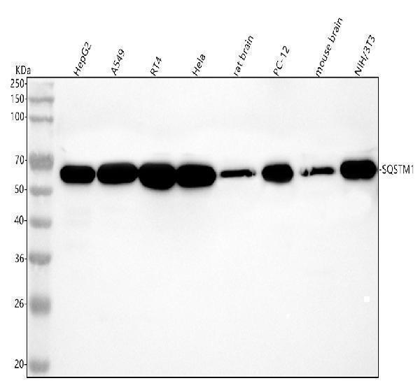  Western blot analysis of p62/SQSTM1 using anti-p62/SQSTM1 antibody (M00300)
