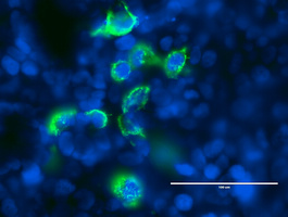 m00301 2 anti alk mouse monoclonal antibody clone id oti1b2 if testing 2