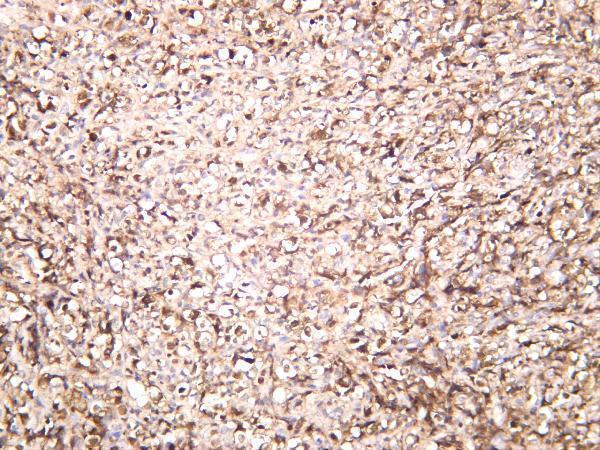 m00301 5 alk primary antibodies ihc testing 1