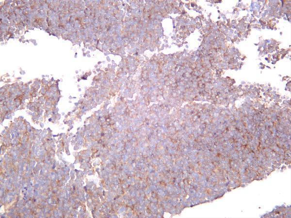 m00301 5 alk primary antibodies ihc testing 2