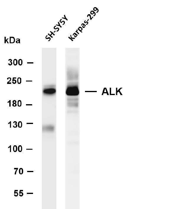 m00301 5 alk primary antibodies wb testing 1