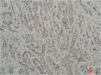 m00302 1 tbp primary antibodies ihc testing 2