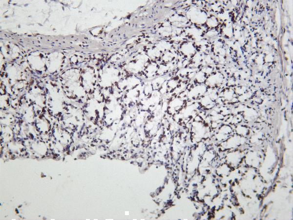 m00302 2 tbp primary antibodies ihc testing 4