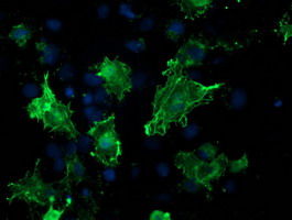 m00303 1 anti vasp mouse monoclonal antibody clone id oti4d6 if testing 13