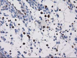 Immunohistochemical staining of paraffin-embedded Human endometrium tissue within the normal limits using anti-VASP mouse monoclonal antibody
