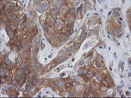 m00303 1 anti vasp mouse monoclonal antibody clone id oti4d6 ihc testing 5