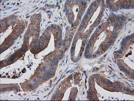 m00303 1 anti vasp mouse monoclonal antibody clone id oti4d6 ihc testing 8