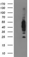 HEK293T cells were transfected with the pCMV6-ENTRY control (Left lane) or pCMV6-ENTRY VASP (Right lane) cDNA for 48 hrs and lysed