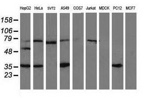 Western blot analysis of extracts (35ug) from 9 different cell lines by using anti-VASP monoclonal antibody