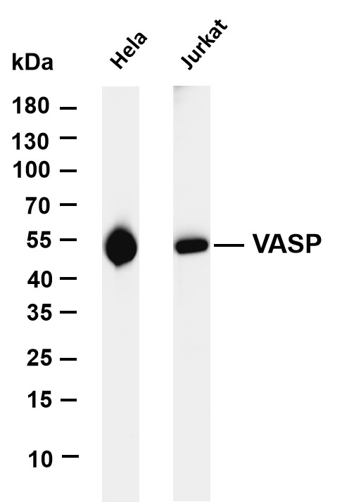 m00303 3 vasp primary antibodies wb testing 1