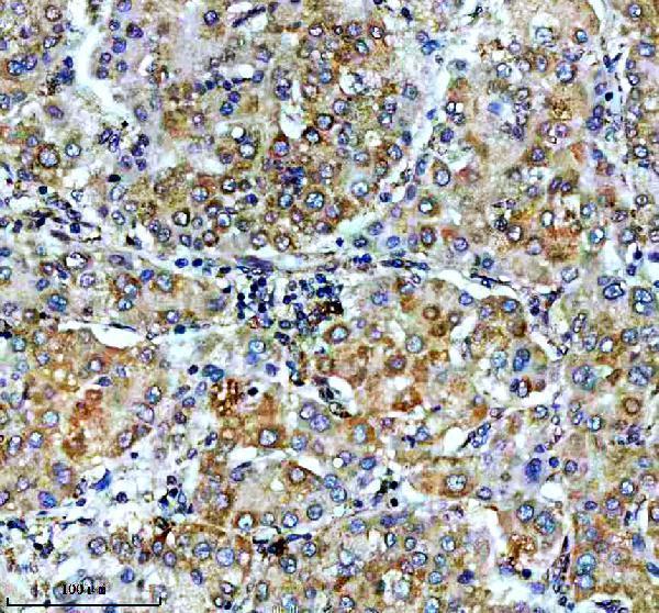 IHC analysis of VASP using anti-VASP antibody (M00303)