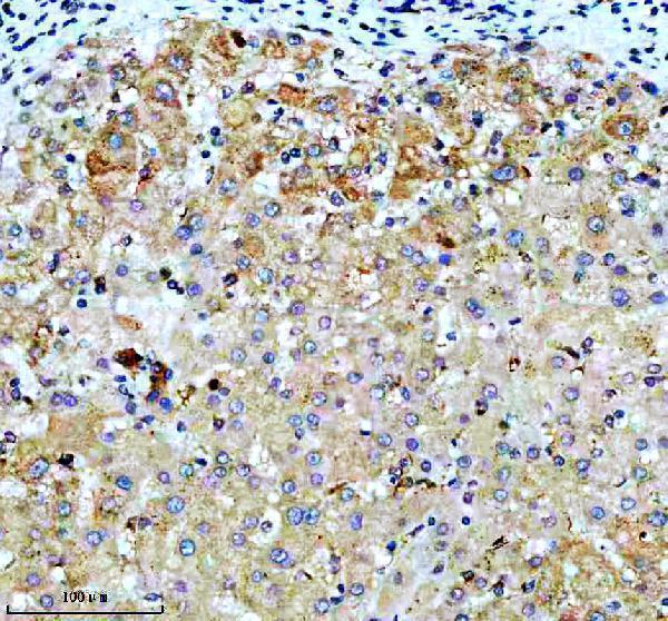 IHC analysis of VASP using anti-VASP antibody (M00303)