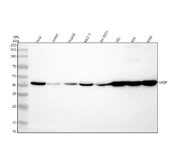 Western blot analysis of VASP using anti-VASP antibody (M00303)
