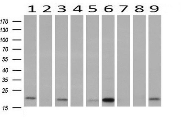 m00304 anti pdf mouse monoclonal antibody clone id oti3f3 wb testing 2