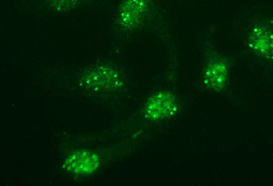 Immunofluorescent staining of HeLa cells using anti-POMC mouse monoclonal antibody (M00305-2)