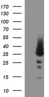 HEK293T cells were transfected with the pCMV6-ENTRY control (Left lane) or pCMV6-ENTRY POMC (Right lane) cDNA for 48 hrs and lysed