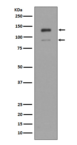 Western blot analysis of IFNAR1 expression in K562 cell lysate
