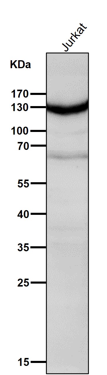 All lanes use the Antibody at 1:5K dilution for 1 hour at room temperature