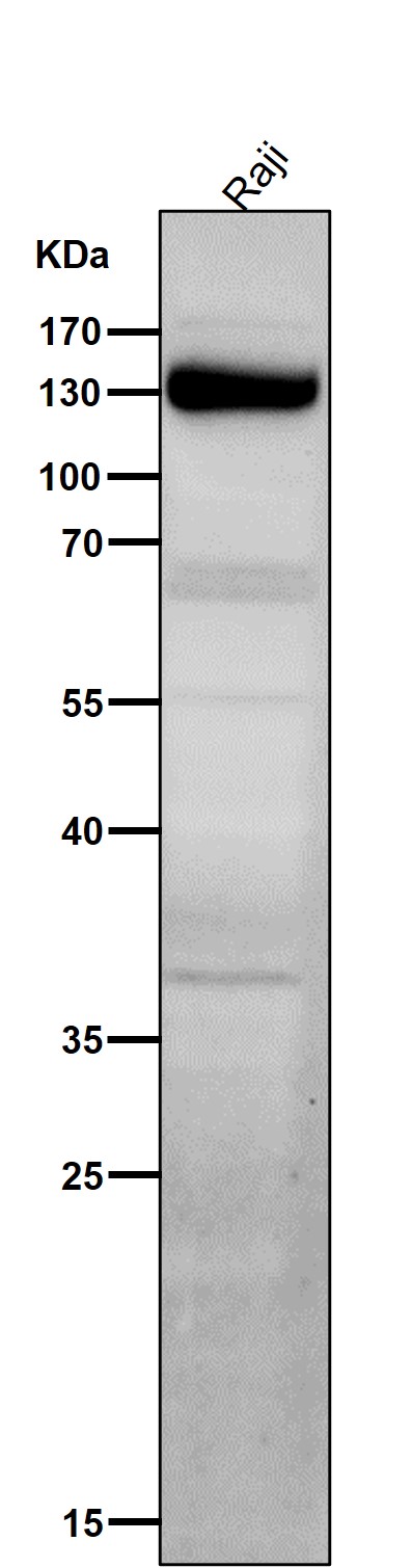 All lanes use the Antibody at 1:5K dilution for 1 hour at room temperature