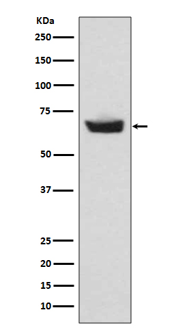 Western blot analysis of CETP expression in human plasma lysate