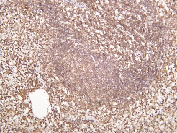 Mouse spleen was stained with anti-Stromal Interaction Molecule 1 rabbit antibody