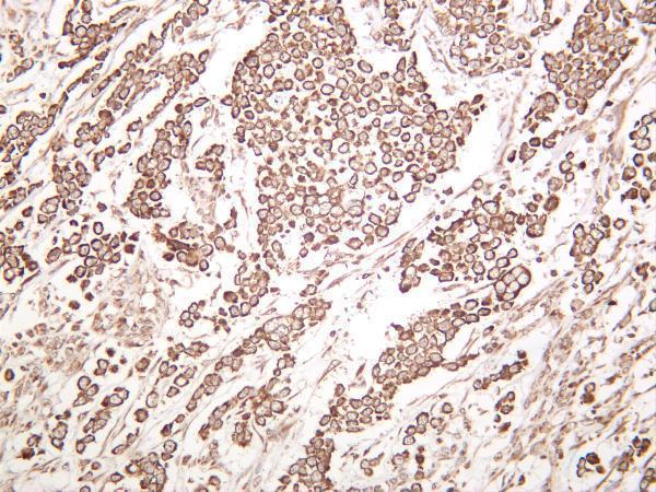Human breast was stained with anti-Stromal Interaction Molecule 1 rabbit antibody