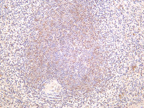 Human spleen was stained with anti-Stromal Interaction Molecule 1 rabbit antibody