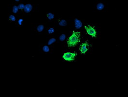 Anti-LPL mouse monoclonal antibody (M00316-1) immunofluorescent staining of COS7 cells transiently transfected by pCMV6-ENTRY LPL