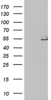 HEK293T cells were transfected with the pCMV6-ENTRY control (Left lane) or pCMV6-ENTRY LPL (Right lane) cDNA for 48 hrs and lysed