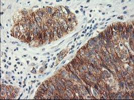 m00316 2 anti lipoprotein lipase lpl mouse monoclonal antibody clone id oti3a10 ihc testing 5