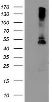 HEK293T cells were transfected with the pCMV6-ENTRY control (Left lane) or pCMV6-ENTRY LPL (Right lane) cDNA for 48 hrs and lysed