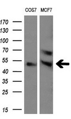 Western blot analysis of extracts (10ug) from 2 different cell lines by using anti-LPL monoclonal antibody (1:200)