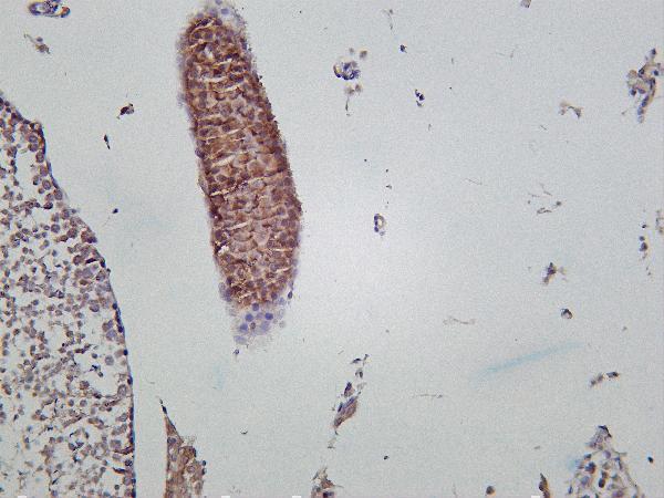 m00318 3 pik3r1 primary antibodies ihc testing 1