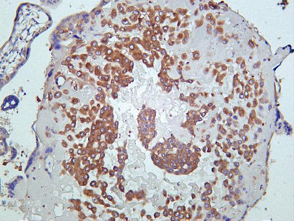 m00318 3 pik3r1 primary antibodies ihc testing 2