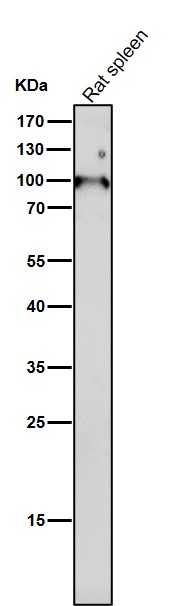 All lanes use the Antibody at 1:1W dilution for 1 hour at room temperature