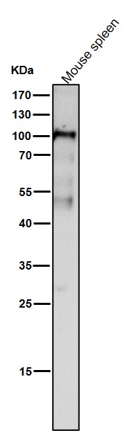 All lanes use the Antibody at 1:1W dilution for 1 hour at room temperature