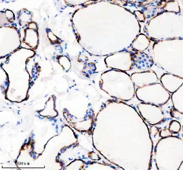 m00320 tpo primary antibodies ihc testing 1