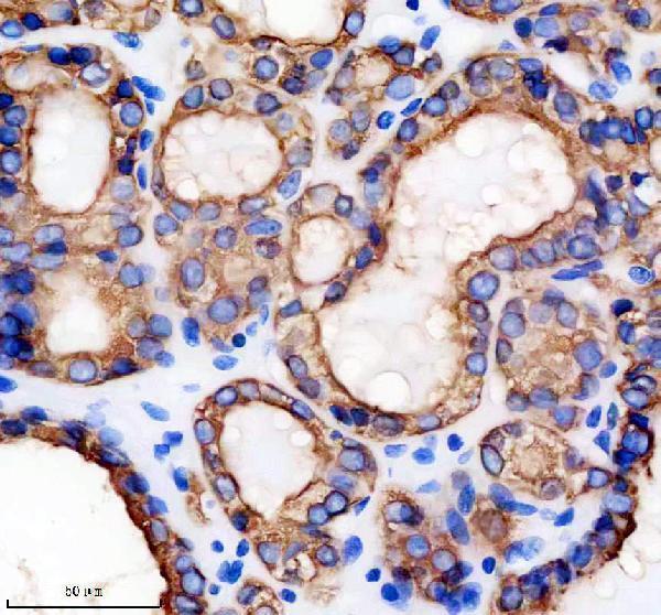 m00320 tpo primary antibodies ihc testing 2
