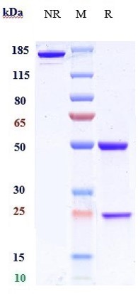 Anti-BACE1 Reference Antibody (Genentech anti-BACE1) on SDS-PAGE under reducing (R) condition
