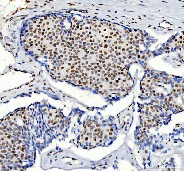 IHC analysis of HDAC2 using anti-HDAC2 antibody (M00325-1)