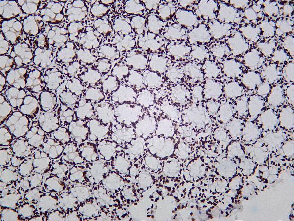 Mouse colon was stained with Anti-HDAC2 rabbit antibody