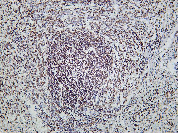 Rat spleen was stained with Anti-HDAC2 rabbit antibody