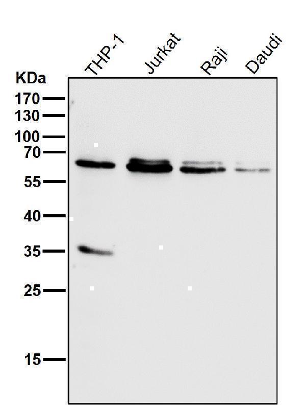 All lanes use the Antibody at 1:1K dilution for 1 hour at room temperature